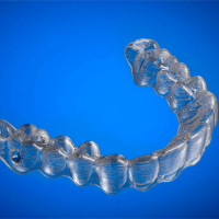 3Dプリントと真空成形で歯科矯正装置を作る